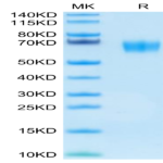 Human SERPINF2/A2AP Protein (SPF-HM101)