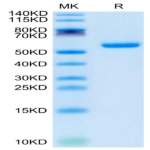 Human CSPG5 Protein (SPG-HM105)