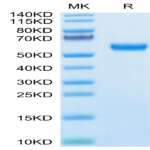 Human SPP1/OPN Protein (SPP-HM101)