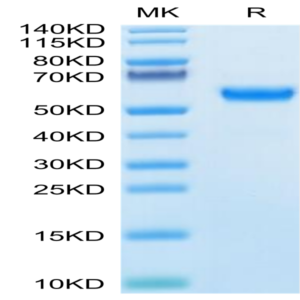 Human SPP1/OPN Protein (SPP-HM101)
