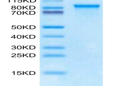 Cynomolgus SFRP2 Protein (SRP-CM102)