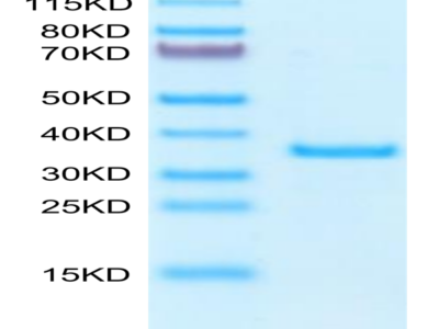 Human SFRP2 Protein (SRP-HM102)