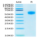 Human SIRP alpha V2/CD172a Protein (SRP-HM1V2)