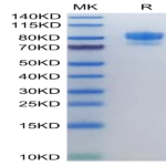 Human SIRP alpha/CD172a Protein (SRP-HM272)