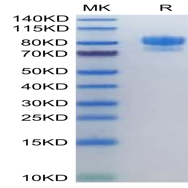 Human SIRP alpha/CD172a Protein (SRP-HM272)