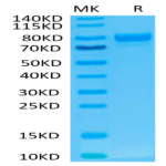 Human SIRP alpha V2/CD172a Protein (SRP-HM2V2)