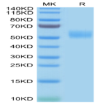 Human SIRP Beta/CD172b Protein (SRP-HM40B)