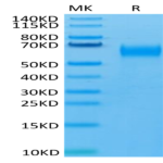 Human SIRP Beta 1 isoform 3 Protein (SRP-HM4BL)