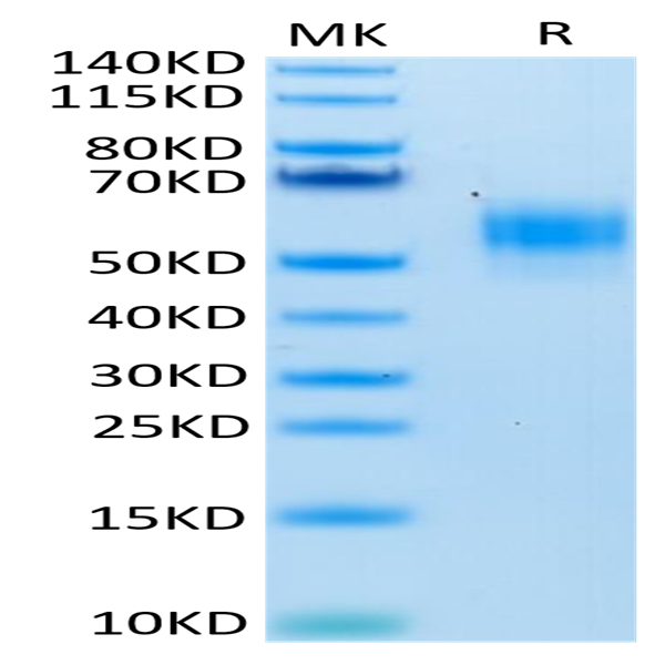 Human SIRP alpha V3 Protein (SRP-HM4V3)