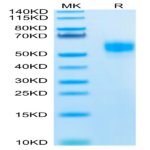 Human SIRP alpha V5 Protein (SRP-HM4V5)
