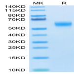 Human SIRP alpha V6 Protein (SRP-HM4V6)