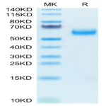 Biotinylated Human SIRP alpha V6 Protein (SRP-HM4V6B)