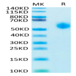 Human SIRP alpha V8 Protein (SRP-HM4V8)