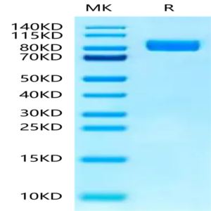 Human IL-1RL1/ST2 Protein (ST2-HM2L1)