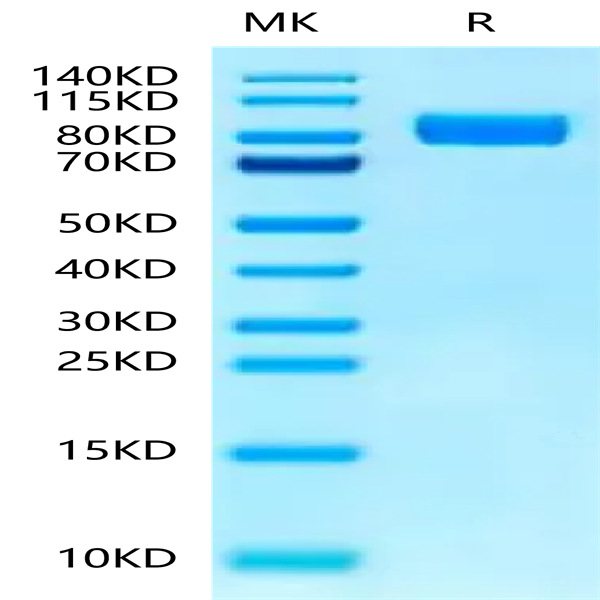 Human IL-1RL1/ST2 Protein (ST2-HM2L1)