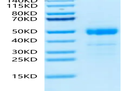 Human ST3GAL4 Protein (ST3-HM1L4HA)