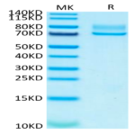 Human Syndecan-1 Protein (SYN-HM201)