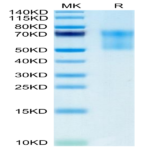 Biotinylated Human Syndecan-1 Protein (SYN-HM401B)