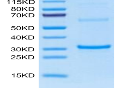 Cynomolgus TPSAB1 protein (TAB-CE1B1)