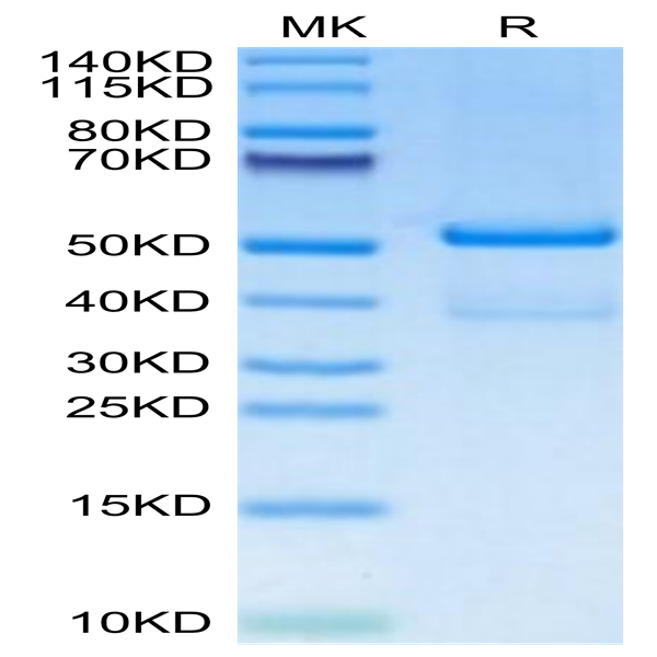 Human TACI/TNFRSF13B Protein (TAC-HM213)