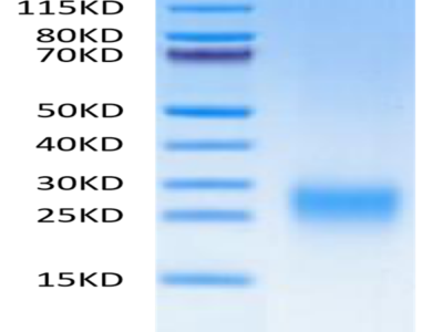 Human TDGF1/Cripto Protein (TDG-HM101)