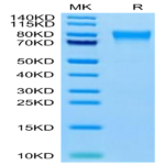 Human TEM7R/PLXDC2 Protein (TEM-HM17R)