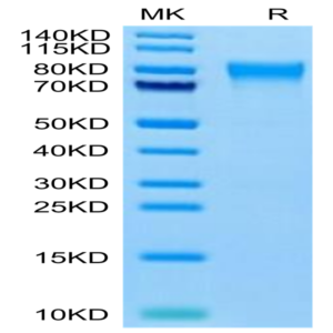 Human TEM7R/PLXDC2 Protein (TEM-HM17R)