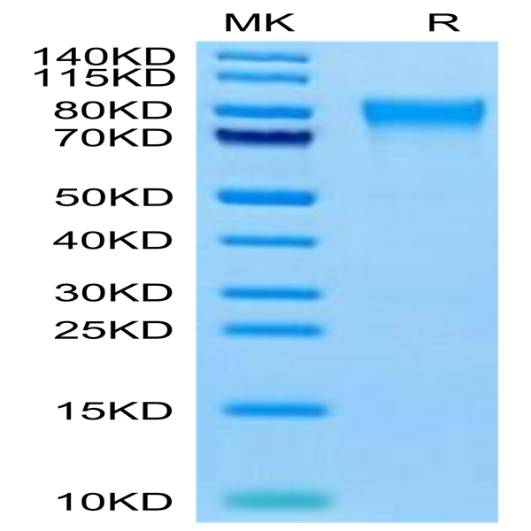 Human TEM7R/PLXDC2 Protein (TEM-HM17R)