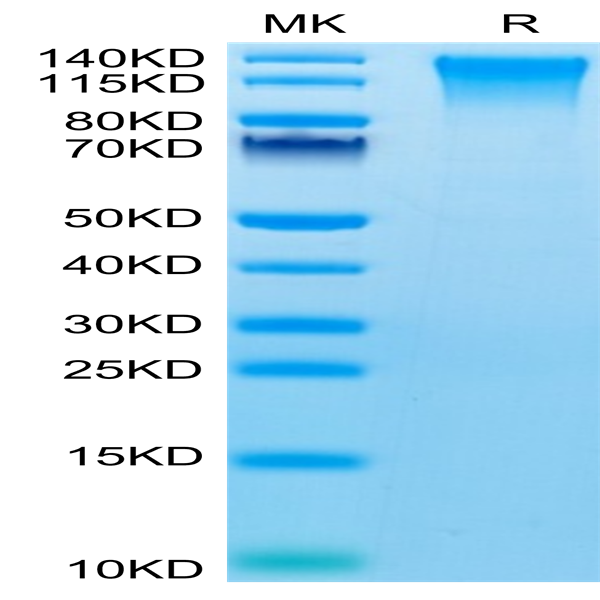 Mouse TEM1/cd248 Protein (TEM-MM148)