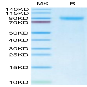 Mouse TEM7R/PLXDC2 Protein (TEM-MM17R)