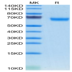 Mouse TMEM106B Protein (TEM-MM26B)