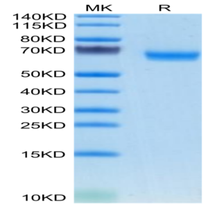 Mouse TMEM106B Protein (TEM-MM26B)