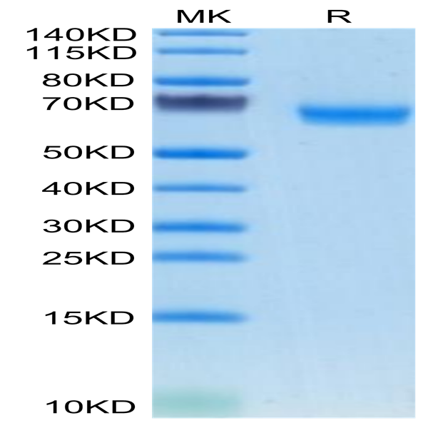 Mouse TMEM106B Protein (TEM-MM26B)