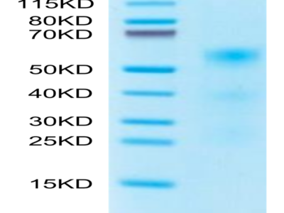 Human TENM2 Protein (TEN-HM1M2)