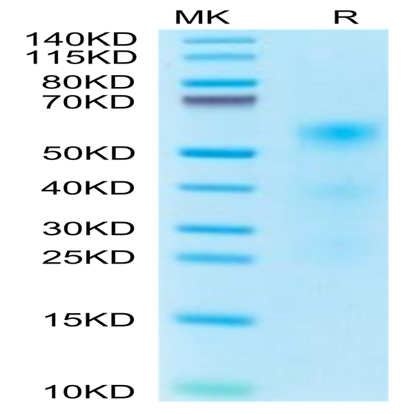 Human TENM2 Protein (TEN-HM1M2) Human TENM2 Protein (TEN-HM1M2)