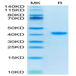 Human TFF1 Protein (TFF-HM201)
