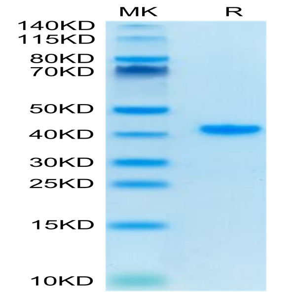 Human TFF1 Protein (TFF-HM201)