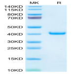 Mouse TFF1 Protein (TFF-MM201)