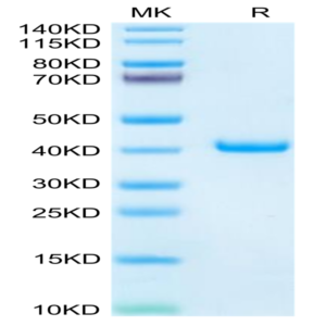 Mouse TFF1 Protein (TFF-MM201)
