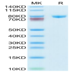 Human Transferrin Protein (TFN-HM101)