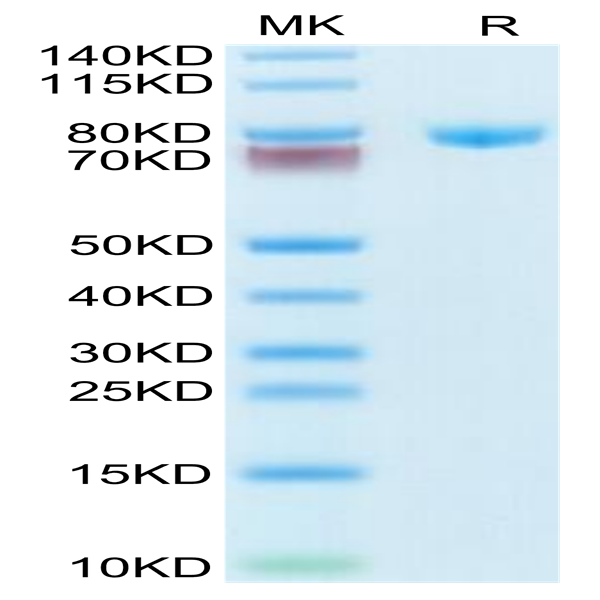Human Transferrin Protein (TFN-HM101)