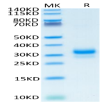 Human TFPI-2 Protein (TFP-HM102)