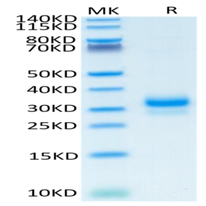 Human TFPI-2 Protein (TFP-HM102)