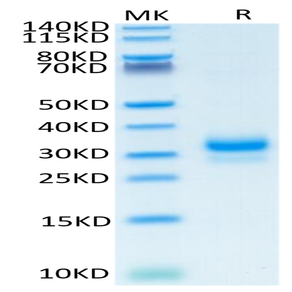 Human TFPI-2 Protein (TFP-HM102) Human TFPI-2 Protein (TFP-HM102)