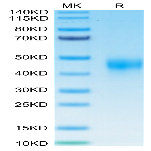 Human TFPI Protein (TFP-HM401)
