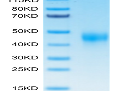Biotinylated Human TFPI Protein (TFP-HM401B)