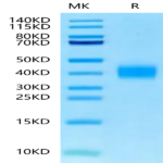 Mouse TFPI-2 Protein (TFP-MM102)