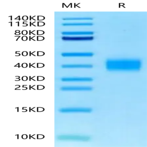 Mouse TFPI-2 Protein (TFP-MM102)