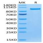 Human Transferrin R/CD71 Protein (TFR-HM201)