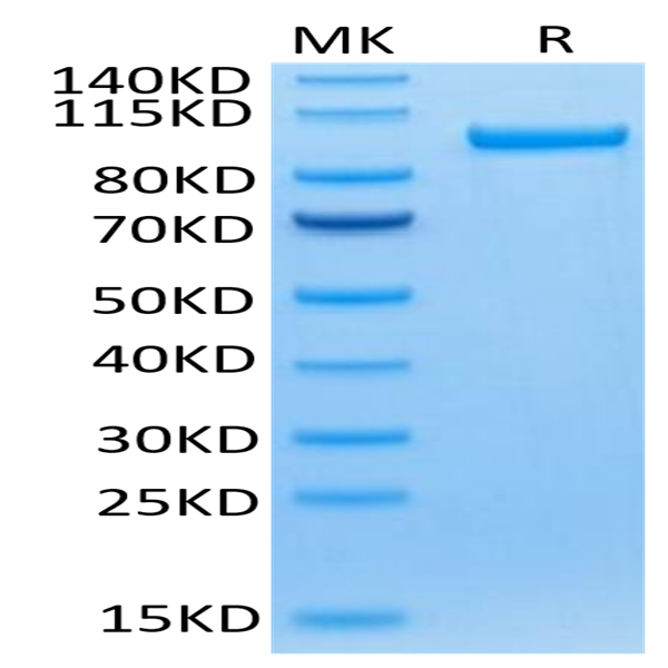 Human Transferrin R/CD71 Protein (TFR-HM201)